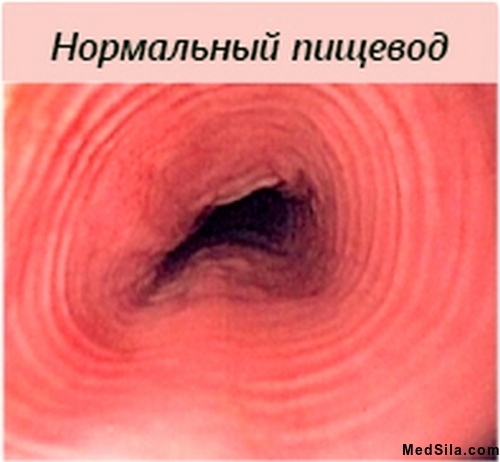 нормальный пищевод